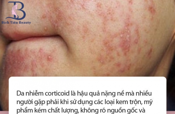 PHỤC HỒI DA